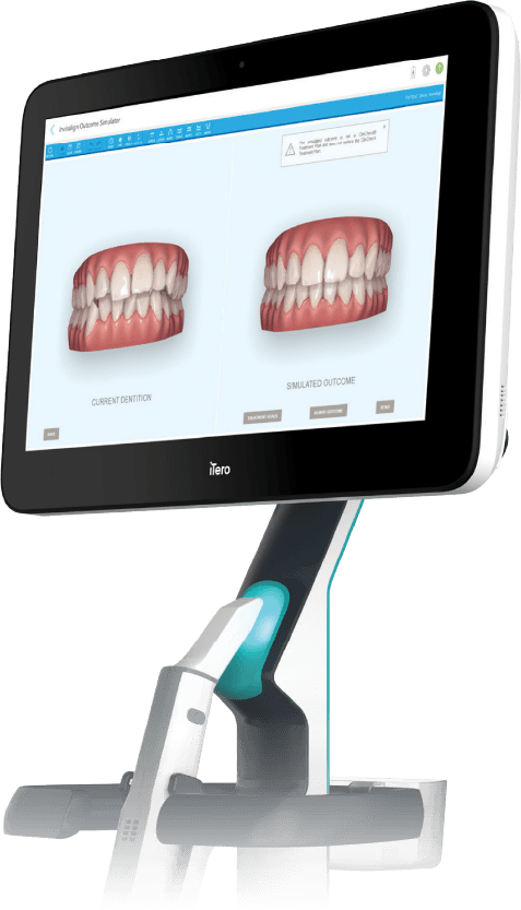 เครื่องสแกนฟันดิจิทัล iTero สำหรับวางแผนจัดฟันใส Invisalign